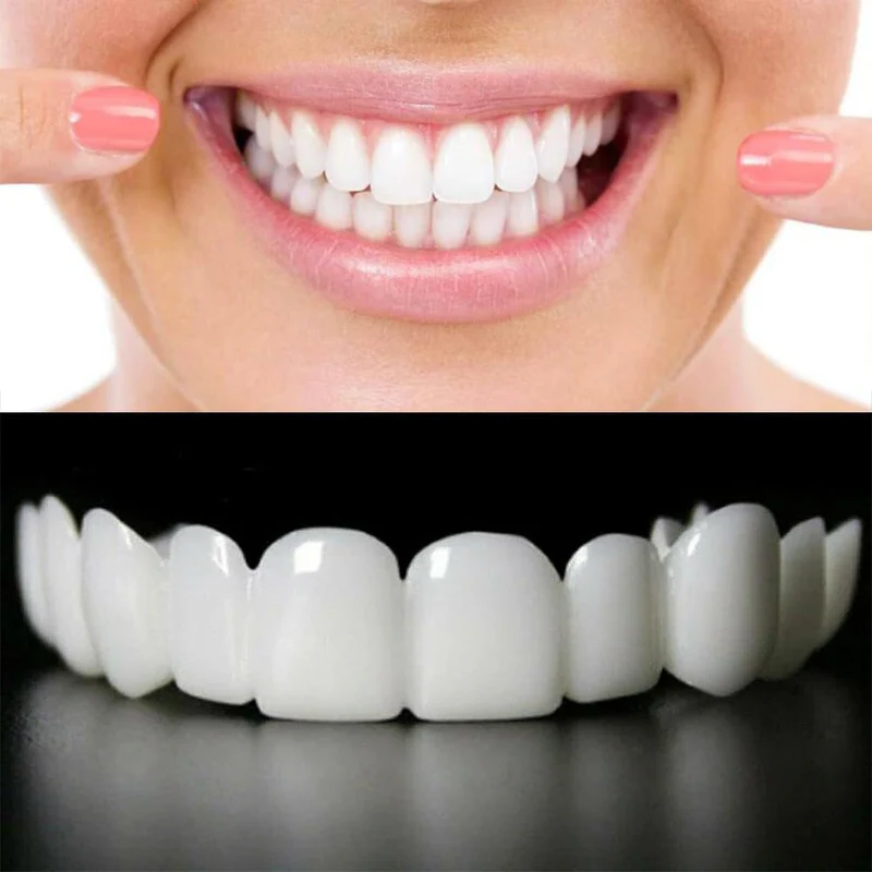 View 3 of Snap On Smile