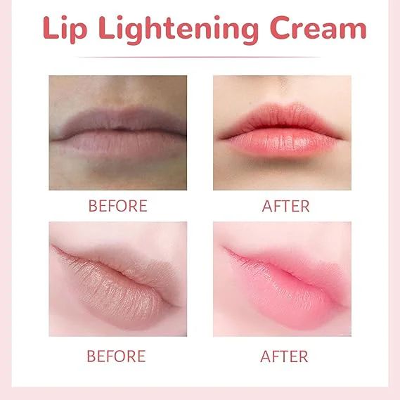 View 2 of Lips Bleaching Cream Balm