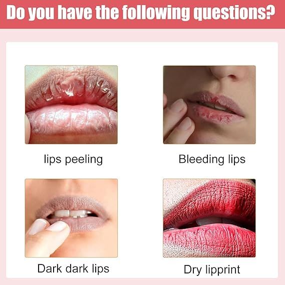 View 3 of Lips Bleaching Cream Balm